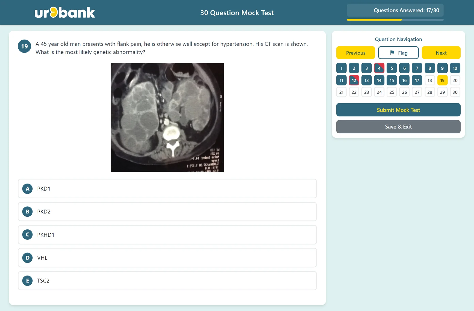 A Urobank mock test: a CT scan question with five answer options, beside the question navigation showing answered and flagged questions